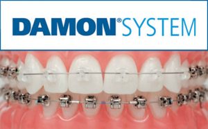 clinica-dental-manrique-y-pedraza-santander-cantabria-ortodoncia-damon-system