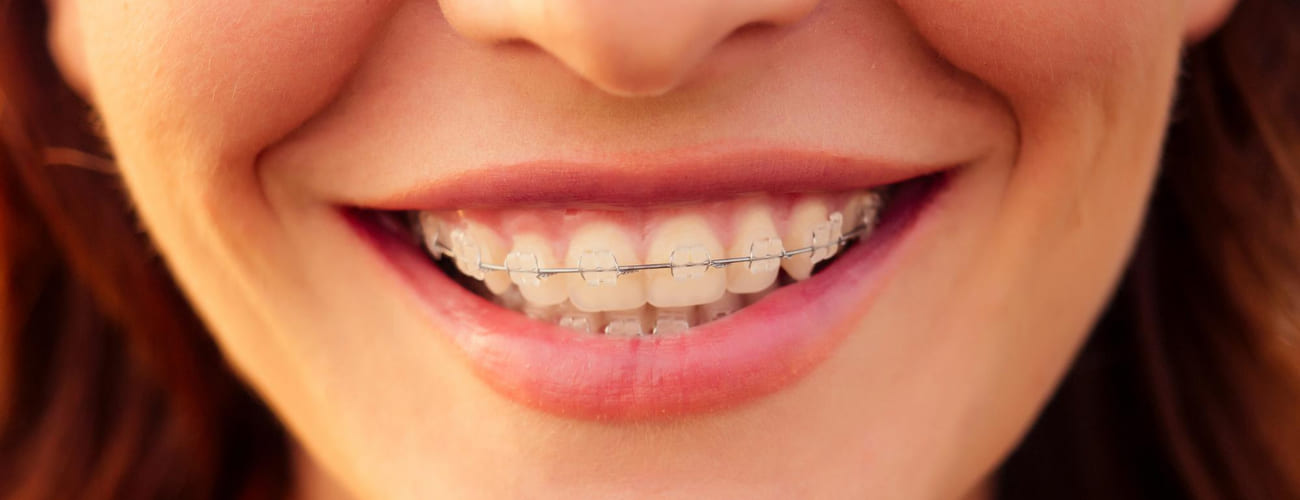 ortodoncia santander