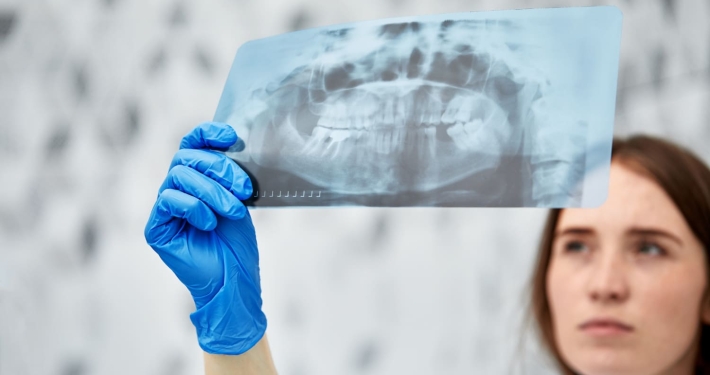 regeneración ósea dental
